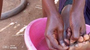 Jigger digging Hellen// African village life