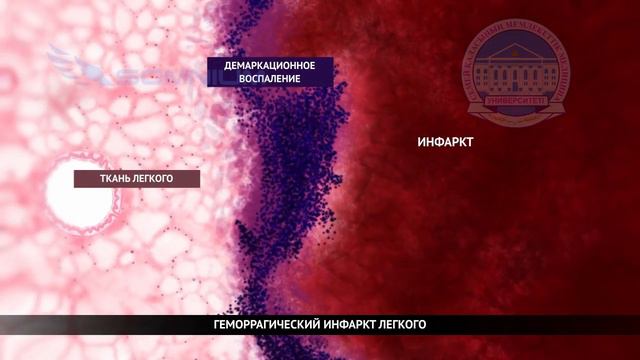 M044 Некроз и апоптоз смотреть онлайн