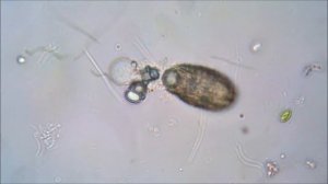 Инфузория Колепс (Coleps) съедает амёбу с парамиловыми зернами.