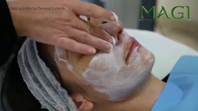 trattamento di peeling del volto eseguito con Prx T33 смотреть онлайн