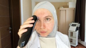 Вакуумная чистка лица! Неожиданна такого крутого результата!