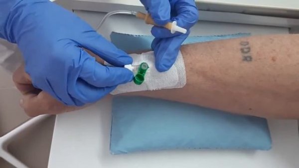 Промывание катетера