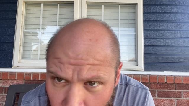 Doctor prescribed off-label drug to fight against my hair loss -1 month смотреть онлайн