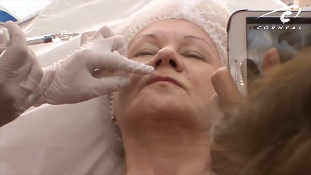 Выворачиваем губу для увеличения объема смотреть онлайн
