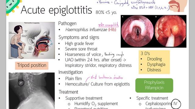 Review of Respiratory tract infections (Preclinic) смотреть онлайн