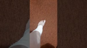 Состояние после удаления пластины с голеностопа.