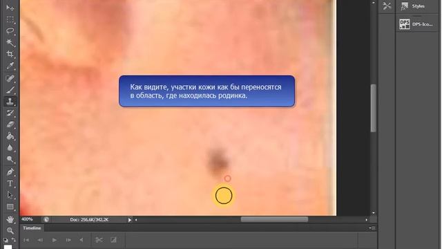 Как убрать прыщ, как убрать родинку с фотографии? Как обработать портрет? смотреть онлайн
