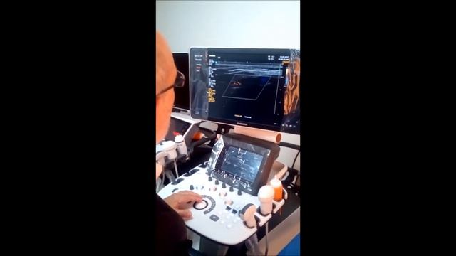 Doppler Arterias del Pié 4. Abordaje y Ajustes. H60 Samsung. смотреть онлайн