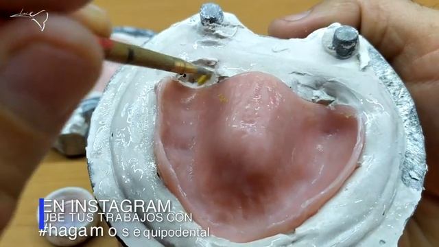 CÓMO HACER UN REBASE A UNA PRÓTESIS DENTAL DE ACRÍLICO PASO A PASO смотреть онлайн