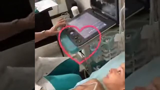 Детский кардиолог. Врач-узи сердца. Курахова Айшат ( она же и Бурлият) Абдулаевна. смотреть онлайн