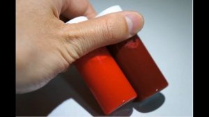 Периферический венозный катетер: техника постановки и всё, что новичку хотелось бы знать об этом