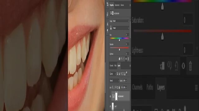 تبييض الاسنان بالفوتوشوب - Photoshop teeth whitening смотреть онлайн