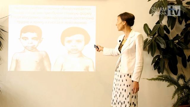 Сколиоз, кифоз, лордоз