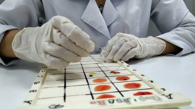 Сross blood group/ГРУППА КРОВИ. КАК ОПРЕДЕЛИТЬ ПЕРЕКРЁСТНЫМ МЕТОДОМ смотреть онлайн