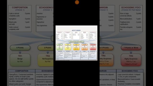 Thyroid Nodule TI RADS (ACR) смотреть онлайн