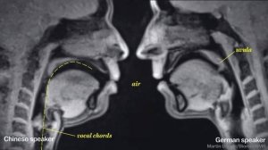 Занимаются любовью в МРТ