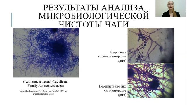 РЕЗУЛЬТАТ АНАЛИЗА МИКРОБИОЛОГИЧЕСКОЙ ЧИСТОТЫ ЧАГИ смотреть онлайн