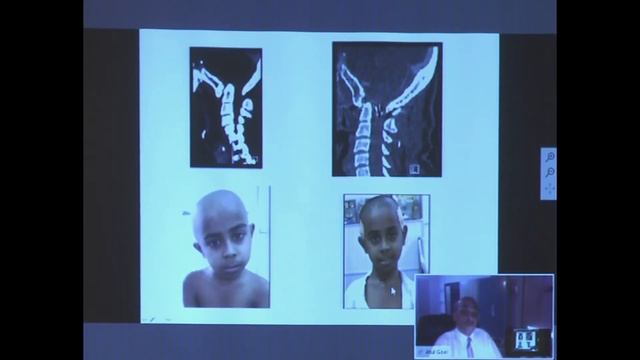 2017 XXIX ASAP Conference: About CM & SM - Prof. Atul Goel (India) смотреть онлайн