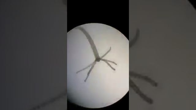 hydra eating daphnia смотреть онлайн