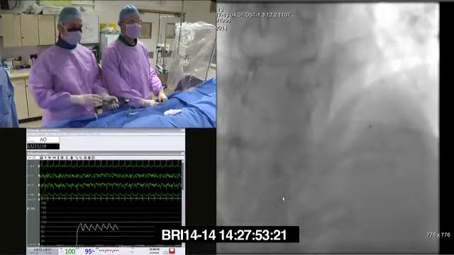 Первичное коронарное вмешательство при ОИМ. Bristol Heart Institute. 2016 смотреть онлайн