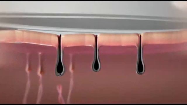 Фотоэпилятор Rio IPL Evolution смотреть онлайн