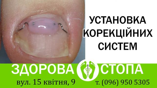 Кабінет Здорова стопа смотреть онлайн