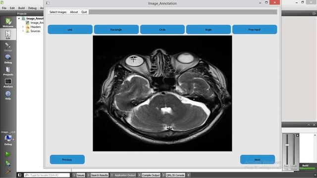 Medical Annotation tool video V1.0 Using Qt GUI framework смотреть онлайн