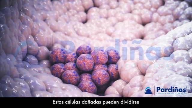 El CÁNCER ORAL - Causas, síntomas y tipos de tumores en la boca © смотреть онлайн