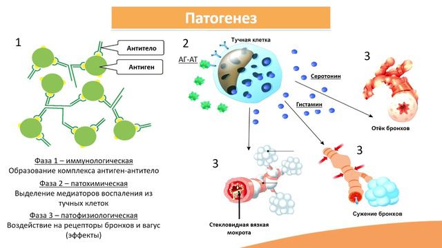 4.5. Бронхиальная астма смотреть онлайн