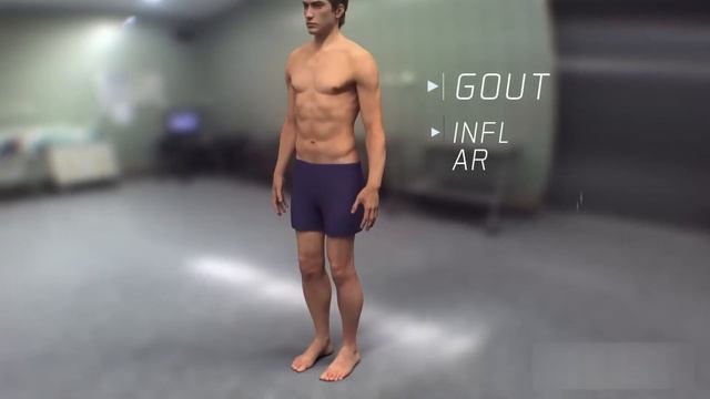 Подагра недуг королей, история проклятья смотреть онлайн