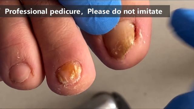 Pedicure tutorial ：What a sharp nail【Xue Yidao】 смотреть онлайн