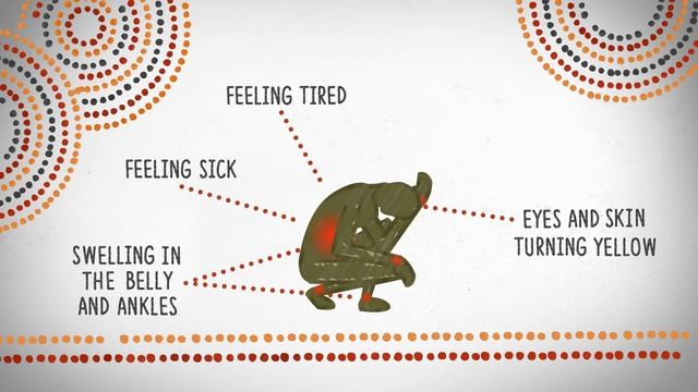 What you need to know about Hepatitis B смотреть онлайн