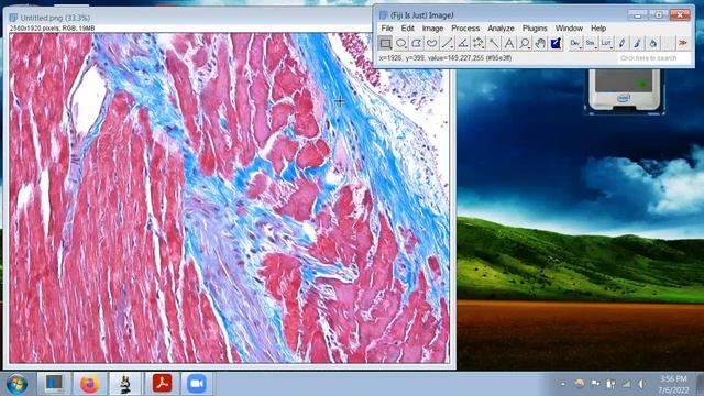 Separating colors in light microscopy images: Color Deconvolution in ImageJ/FIJI смотреть онлайн
