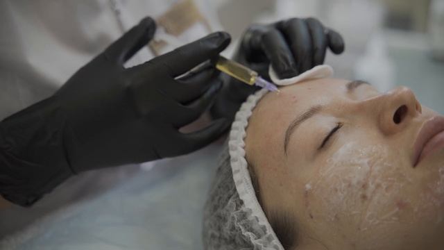 Плазмолифтинг смотреть онлайн