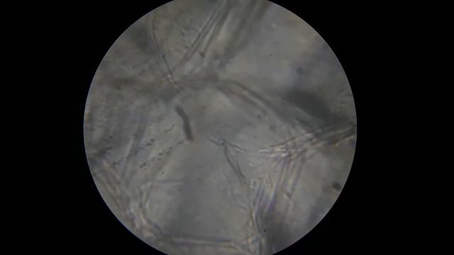 Radish (Raphanus sativus) Under a Microscope: Pulp And Skin смотреть онлайн