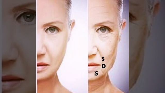 Mandelac Advanced Whitening Cream