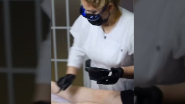 Процесс лазерной эпиляции смотреть онлайн