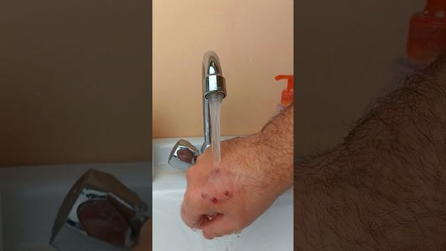 Как избавиться от укуса человека человеком же. Последствия укуса смотреть онлайн