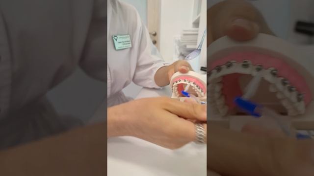 КАК ПРАВИЛЬНО ЧИСТИТЬ ЗУБЫ С БРЕКЕТАМИ!!!)) смотреть онлайн