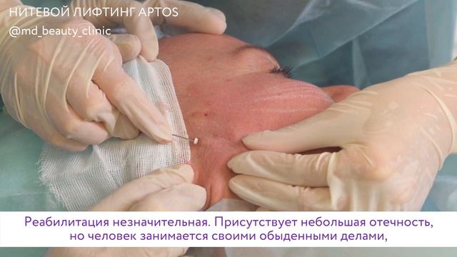 нити APTOS смотреть онлайн