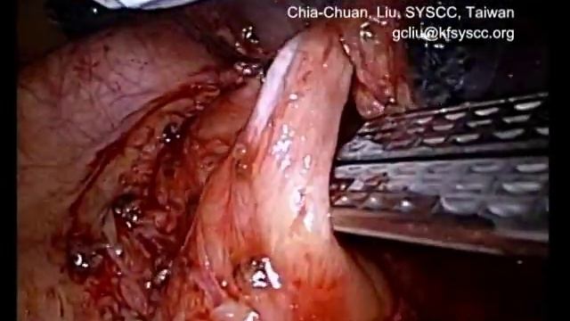 FAQs : Tips for division left SPV смотреть онлайн