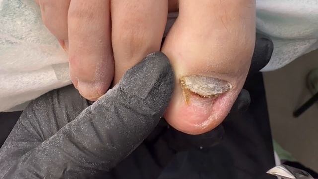 Мысли вслух или совет от подолога