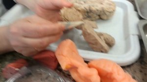 Анатомия | Передний мозг