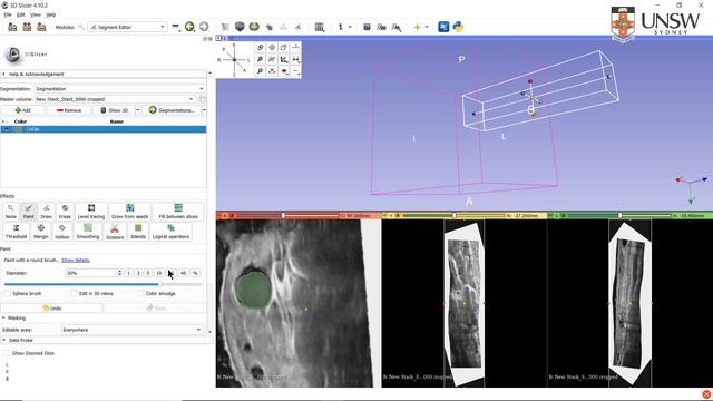 Segmenting geometries using 3D slicer смотреть онлайн