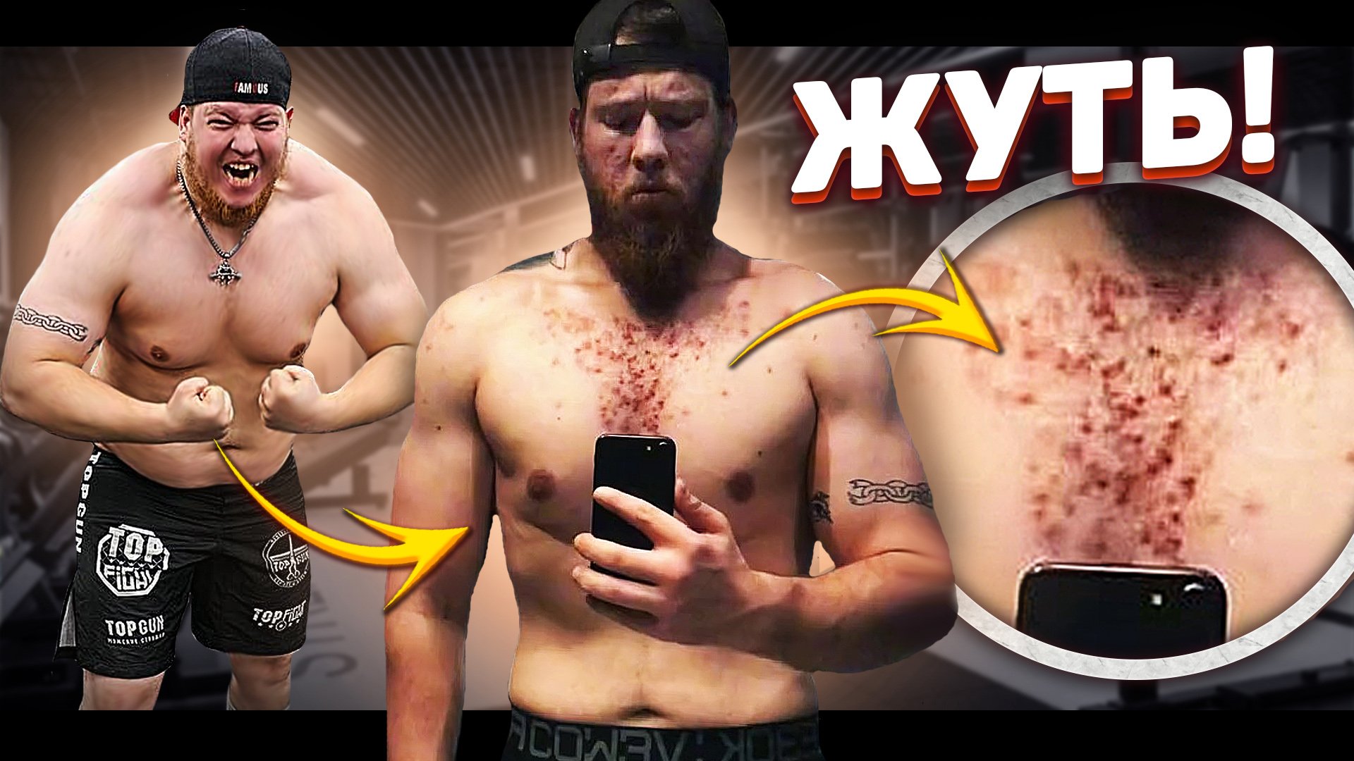 БЫСТРАЯ СУШКА И ПОБОЧНЫЕ ЭФФЕКТЫ СТЕРОИДОВ. СЕРГЕЙ ПОШТАК И ЕГО ИСТОРИЯ смотреть онлайн