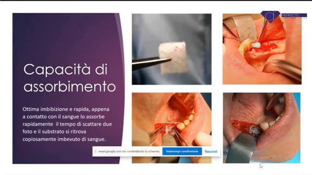 Video Webinar - Cutanplast Fast
