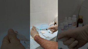 Удаление вен на ногах. Варикоз