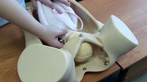 Биомеханизм родов при заднем виде затылочного предлежания