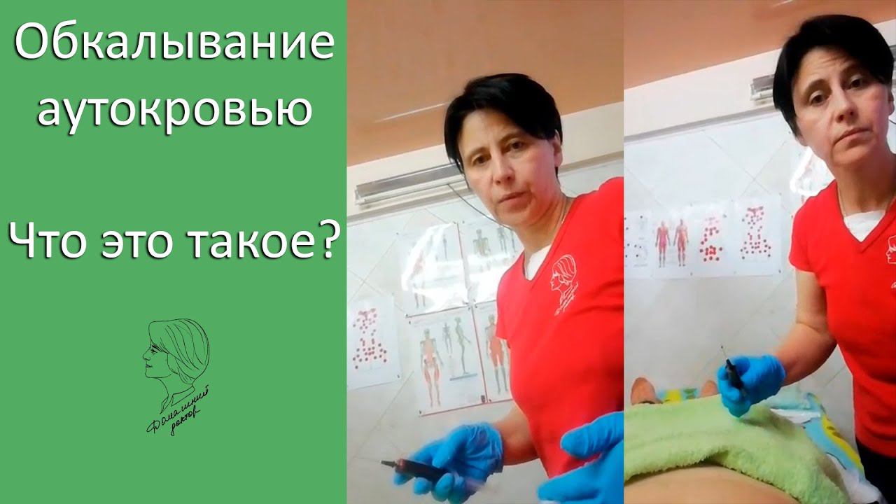 Обкалывание аутокровью. Что это такое? смотреть онлайн