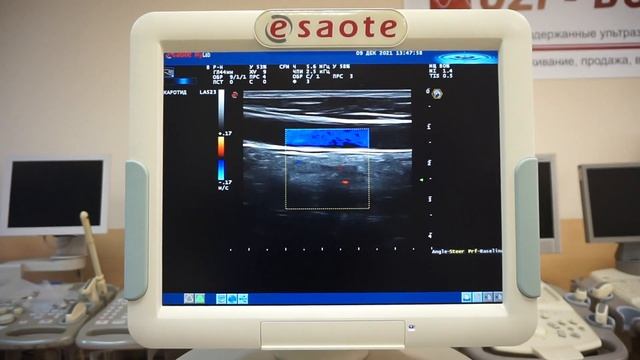 Esaote MyLab 70 обзор ультразвукового сканера смотреть онлайн